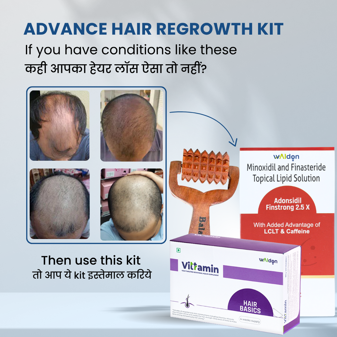 Hair Regrowth Kit for Men: Ultimate Solution to Thicker Hair