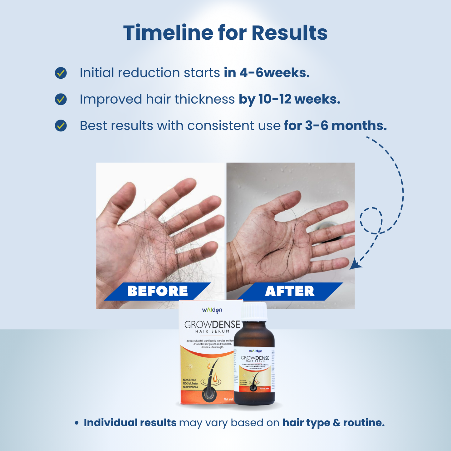 Growdense Hair Serum 30 ml Enriched with Redensyl(5%), Procapil(3%) Anagain(2%)