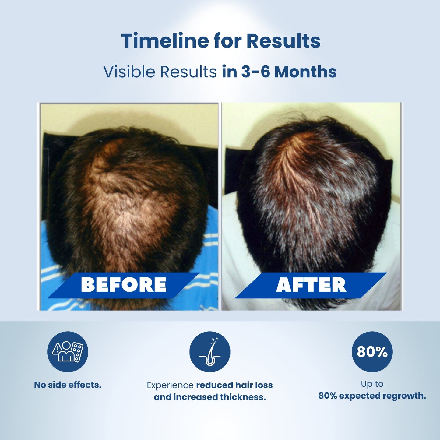 Hair Growth Kit
