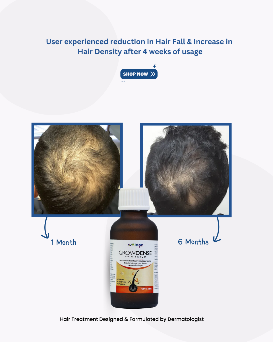 Growdense Hair Serum 30 ml Enriched with Redensyl(5%), Procapil(3%) Anagain(2%)