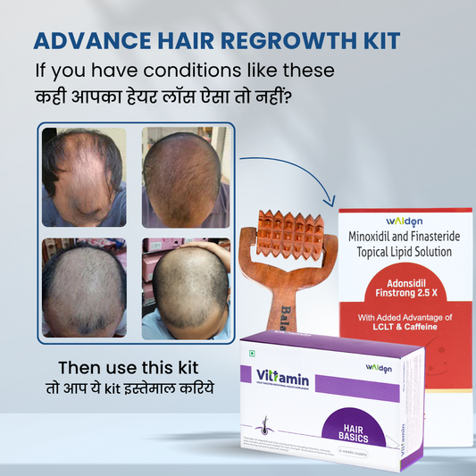 Advance Hair Regrowth Kit
