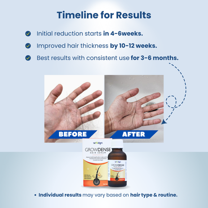 Growdense Hair Serum 30 ml Enriched with Redensyl(5%), Procapil(3%) Anagain(2%)