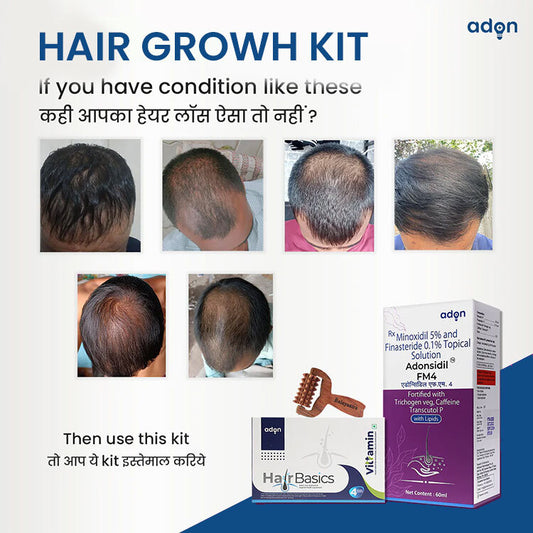 Hair Growth Kit