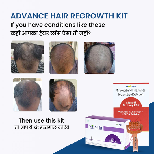 Advance Hair Regrowth Kit